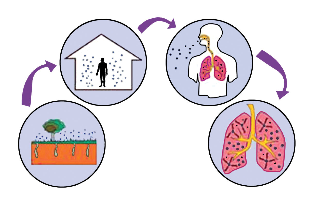 l'inalazione del gas radon induce o funge da concausa del cancro del polmone (rif. foto Radon Gas Manuale)